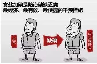 這三類人不檢查“尿碘”，問題就大了