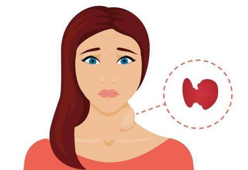 甲亢和吃了太多點碘有關系嗎？導致甲亢的幾大誘因，要重視