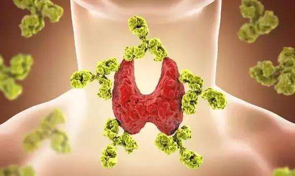 尿碘檢測儀專家提醒甲狀腺疾病患者應(yīng)如何保證碘適量？