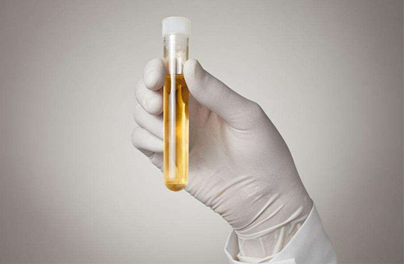 科學(xué)補(bǔ)碘，要從測碘開始