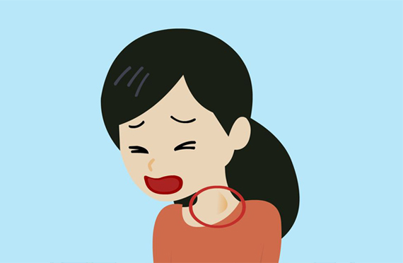 碘缺乏病的種類與癥狀有哪些？