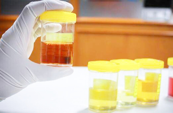 科學(xué)測碘，一生健康!