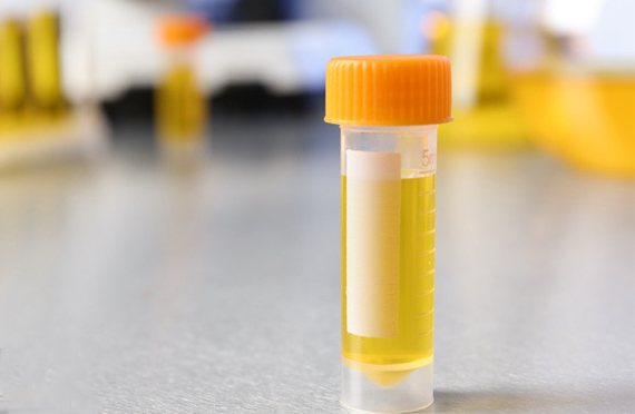 一次尿碘檢測可以反映當(dāng)?shù)氐牡鉅I養(yǎng)情況嗎？