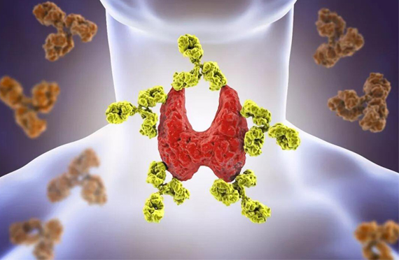  甲減患者需要大量補(bǔ)碘嗎？