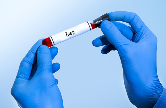 目前碘營(yíng)養(yǎng)水平的評(píng)價(jià)標(biāo)準(zhǔn)有哪些？