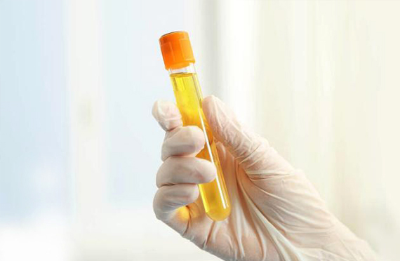 碘多碘少？尿碘檢測可以幫您