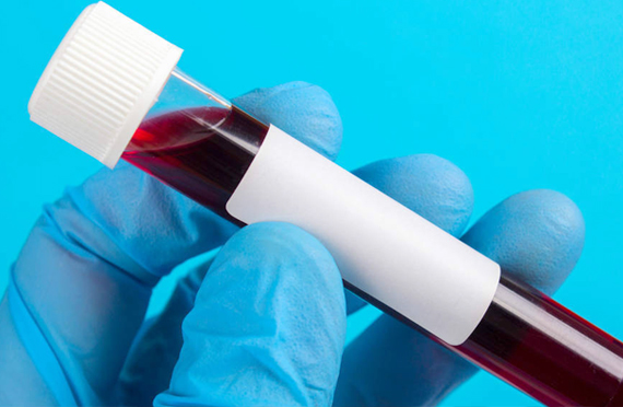 檢測(cè)血碘是為了什么？