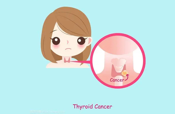 甲狀腺癌可怕嗎，如何預防？