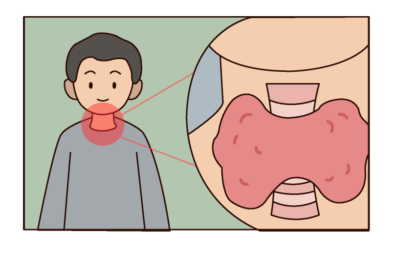 281648454489277942.png 甲狀腺.png