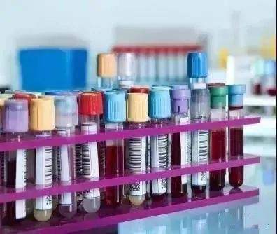 血碘檢測和尿碘檢測哪個更準(zhǔn)確？