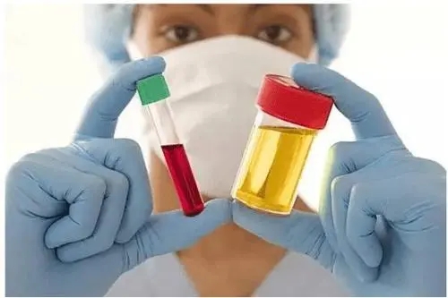 血碘檢測與尿碘檢測該選擇哪個(gè)