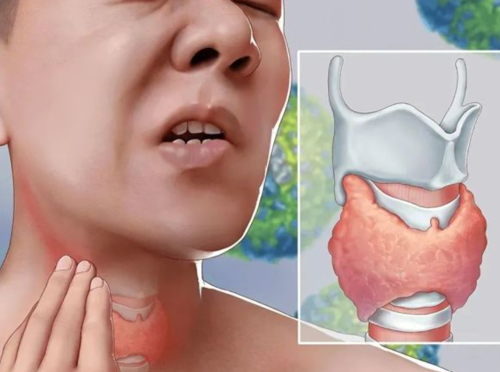 定期進(jìn)行尿碘檢測，預(yù)防甲狀腺疾病帶來的危害